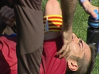 Xavi Torres, tres setmanes de baixa
